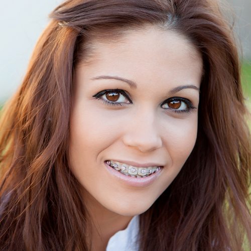 Girl with braces